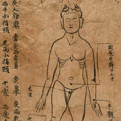 Diagram of moxibustion, ink on paper.
